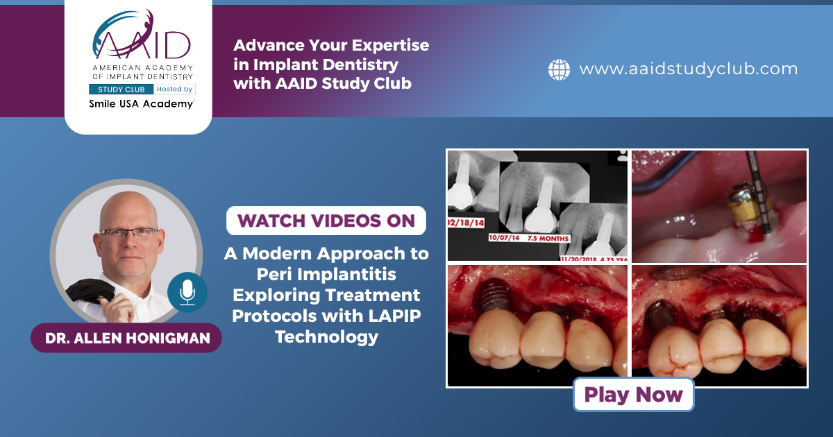A Modern Approach to Peri Implantitis Exploring Treatment Protocols with LAPIP Technology