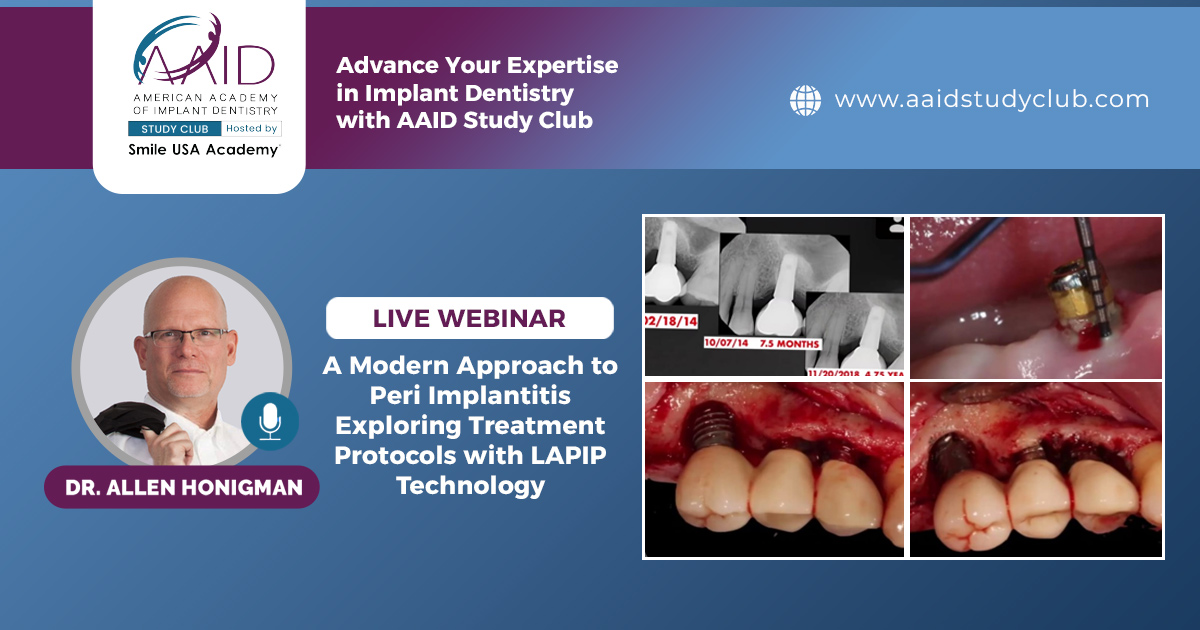 A Modern Approach to Peri Implantitis Exploring Treatment Protocols with LAPIP Technology