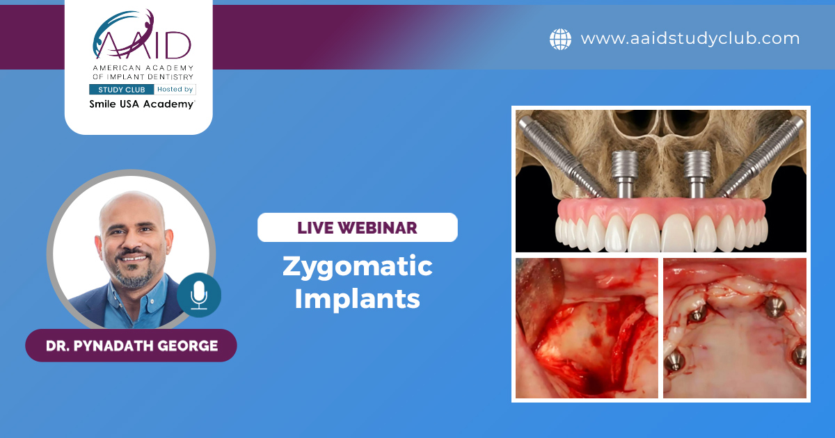 Zygomatic Implants