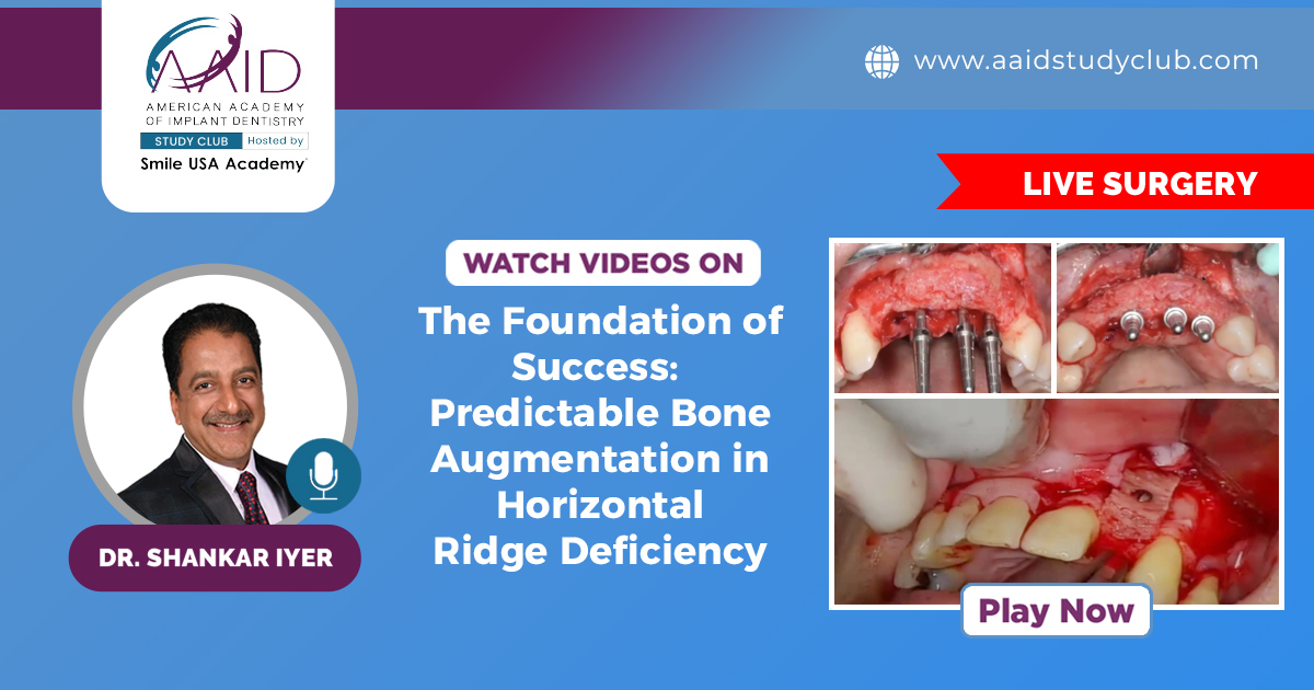 The Foundation of Success: Predictable Bone Augmentation in Horizontal Ridge Deficiency | Live Surgery