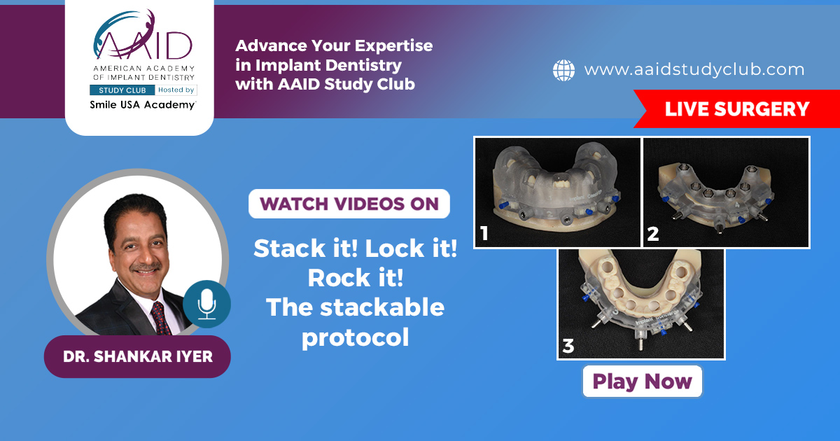 Stack it! Lock it! Rock it! The Stackable Protocol