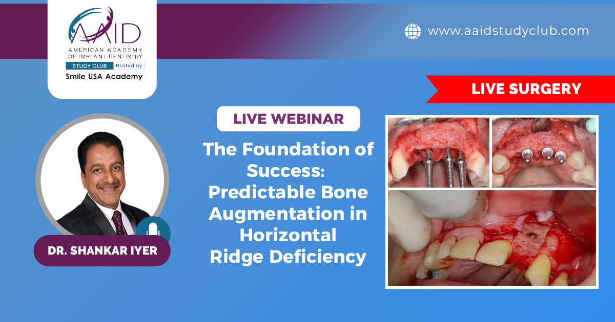 The Foundation of Success: Predictable Bone Augmentation in Horizontal Ridge Deficiency | Live Surgery