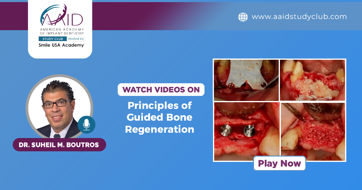 Principles of Guided Bone Regeneration