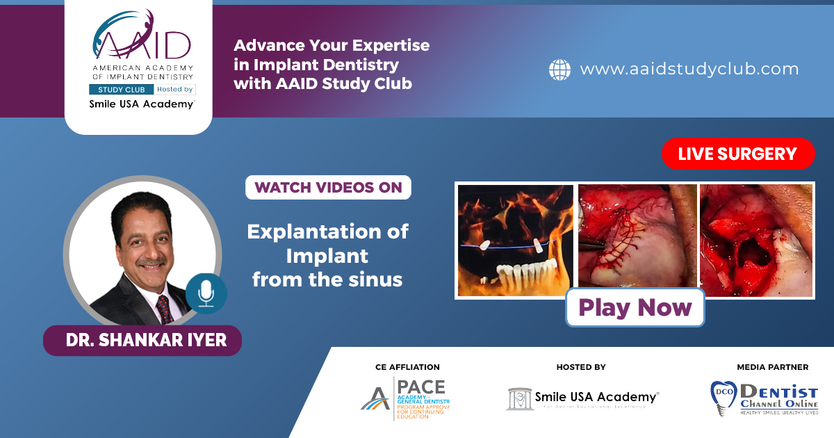 Explantation of Implant from the sinus | LIVE Surgery
