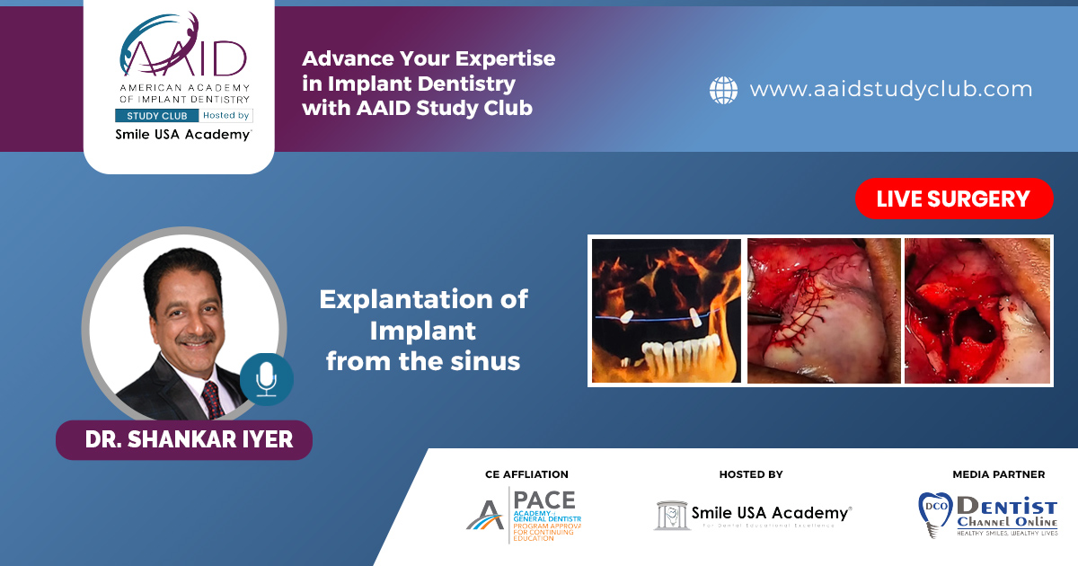 Explantation of Implant from the sinus | LIVE Surgery
