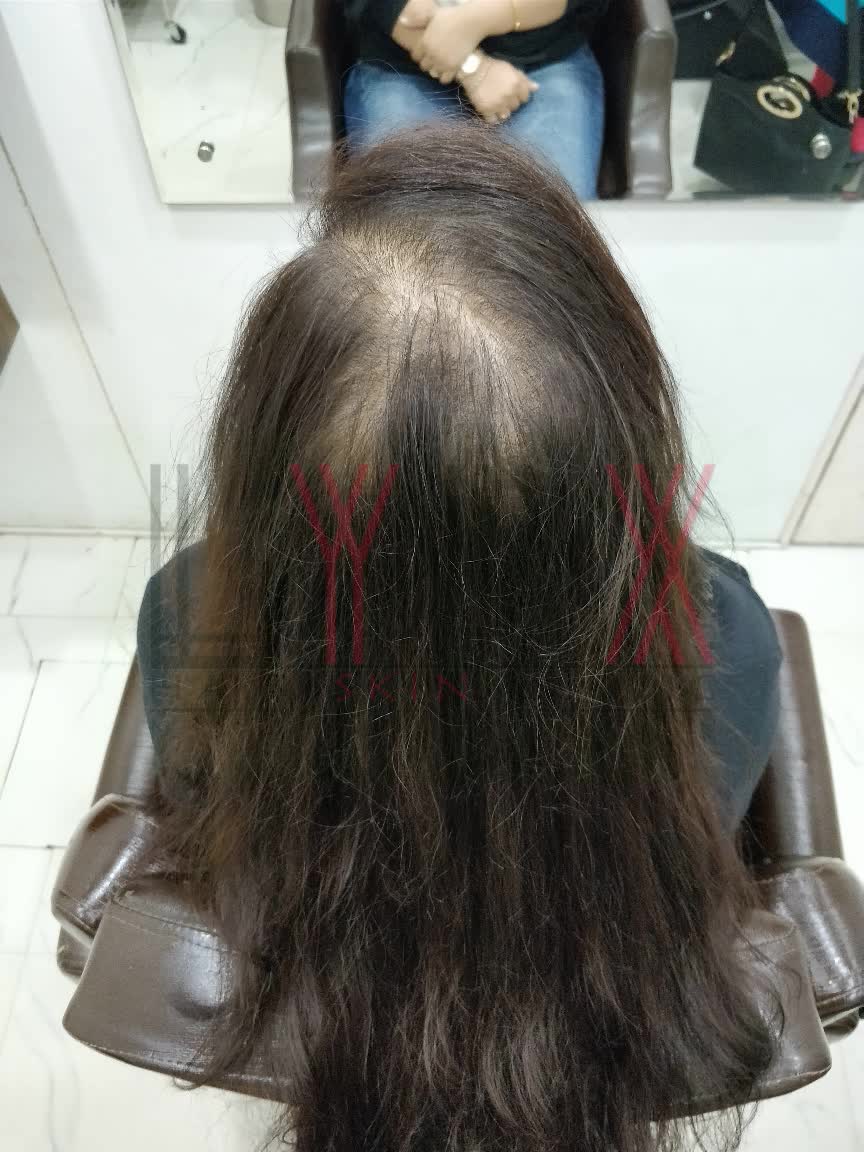 Hair Wigs Weaving Extension In Gurgaon Hair Weaving In Sector