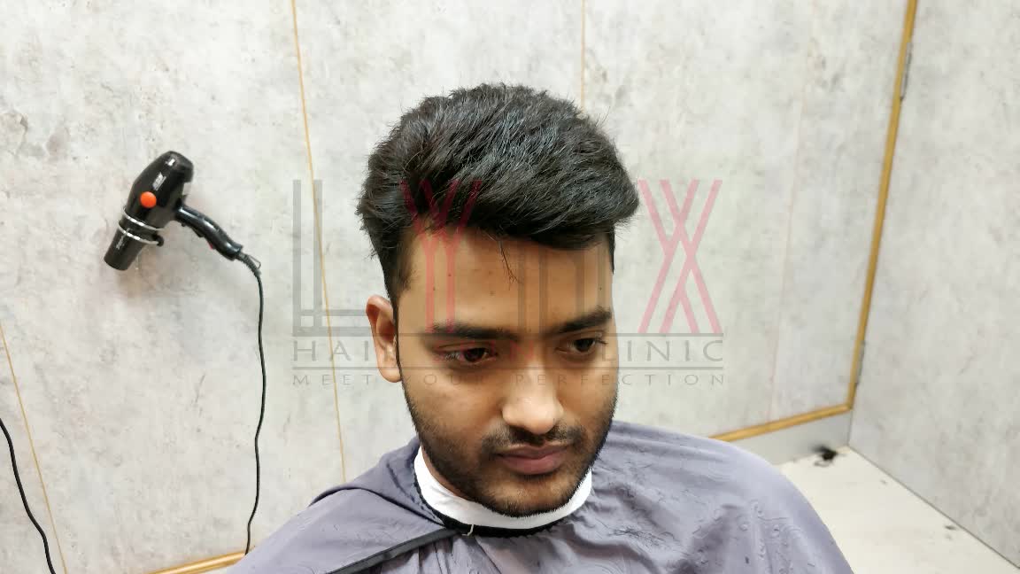 Details 63+ bonding hairstyle images best vova.edu.vn