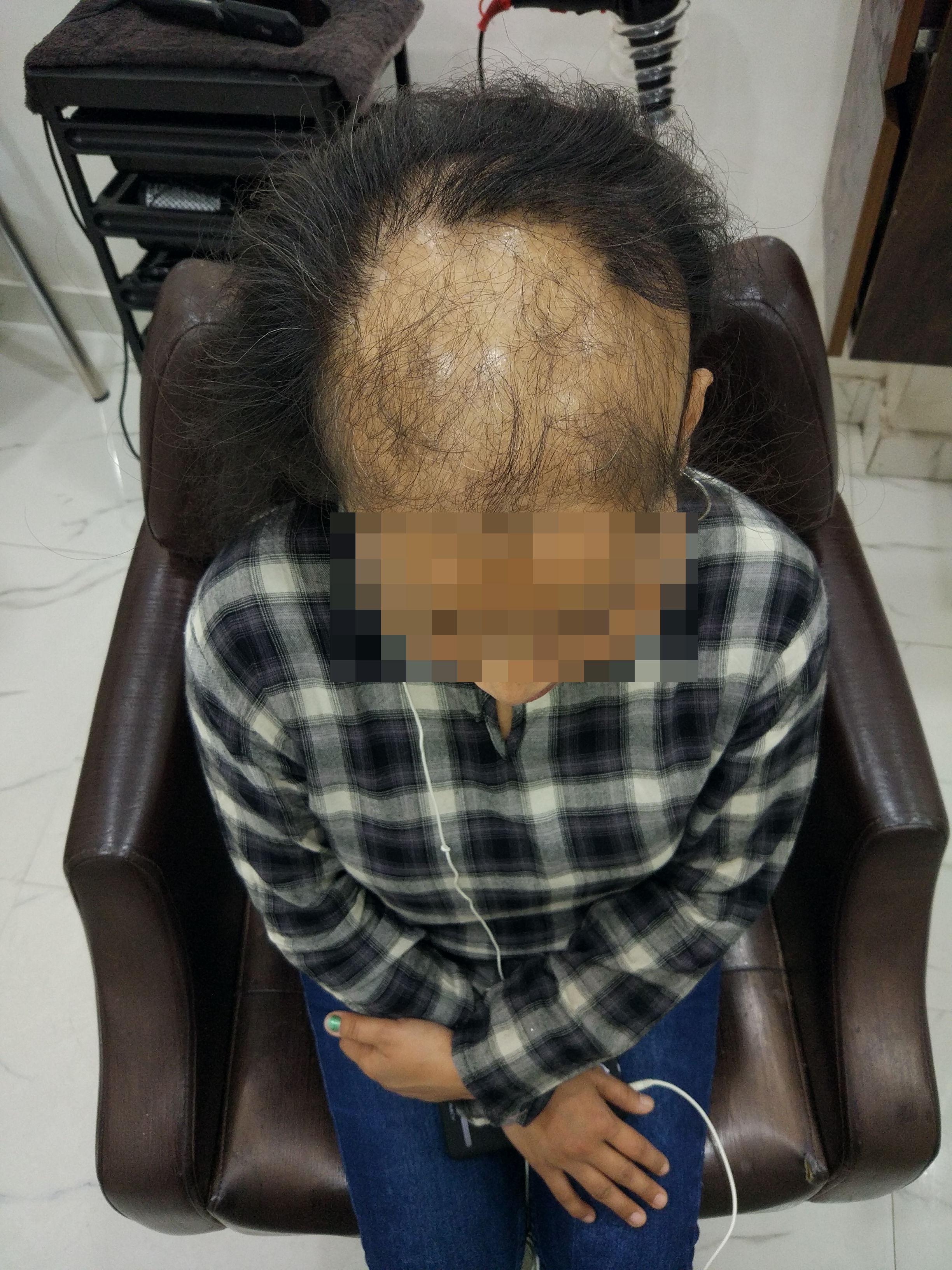 Hair Wigs Weaving Extension In Gurgaon Hair Weaving In Sector