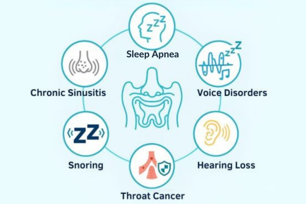 Patients need ENT & Laryngology treatment by ent specialist in mumbai Bombay Hospital