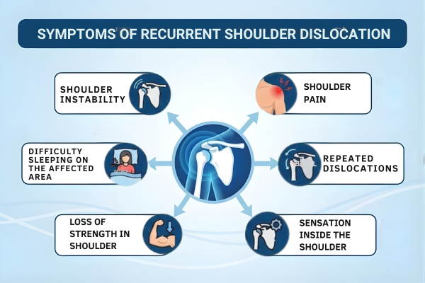 Symptoms of Recurrent Shoulder Dislocation Treated by Dr. Chintan Desai.