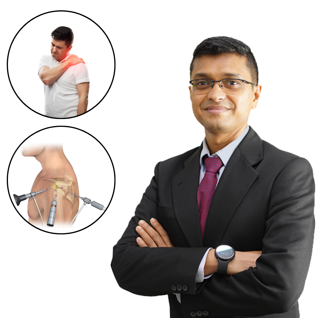 Shoulder Replacement Surgery in mumbai by Dr. Aditya Pawaskar