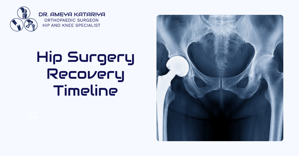 What to Expect After Total Hip Replacement: A Post-Surgery Guide