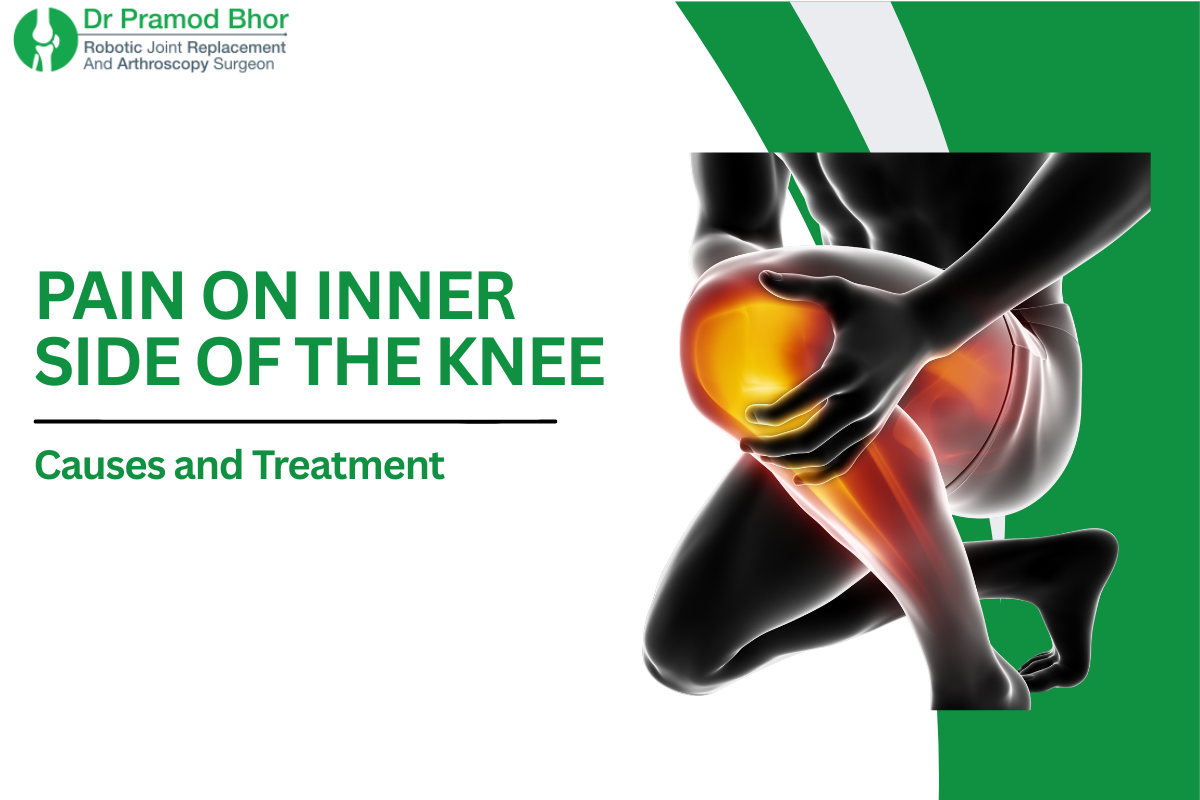 Pain on the Inner Side of the Knee: Causes and Treatment