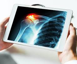Digital X-Ray And Pathology