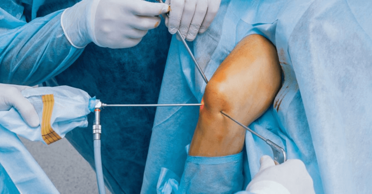 Knee Arthroscopy Surgeon in Kharghar