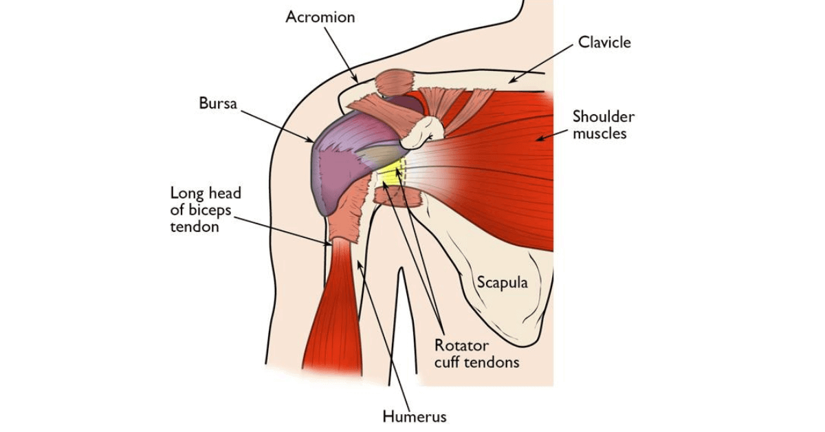 Rotator Cuff Tear Treatment