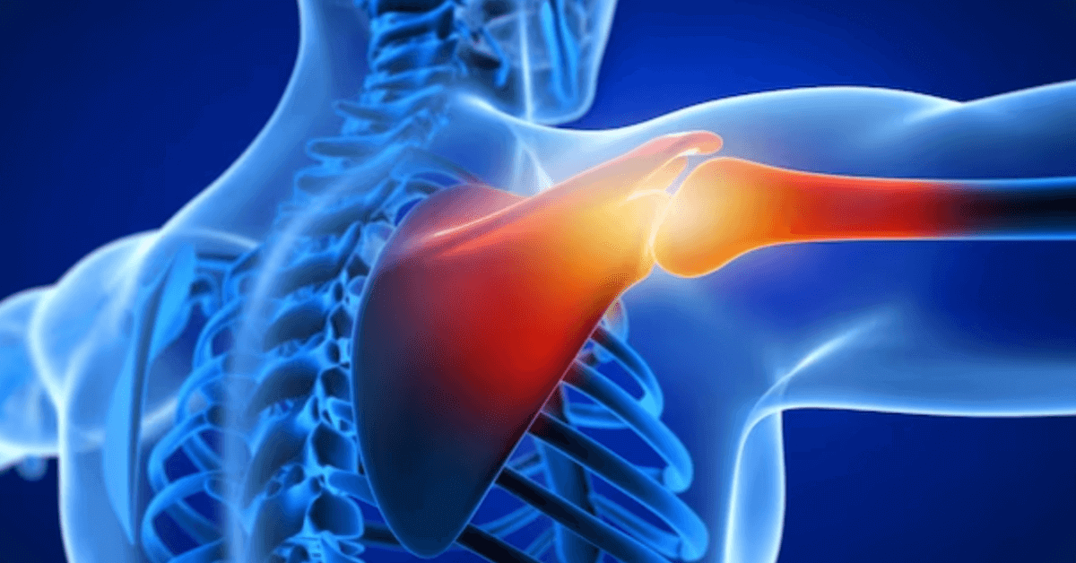 Shoulder Replacement Surgery in Navi Mumbai