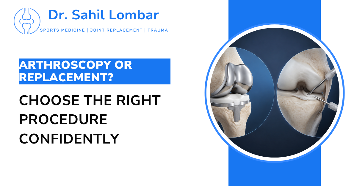 Dr. Sahil Lombar - Joint Replacement vs Arthroscopy in Pune