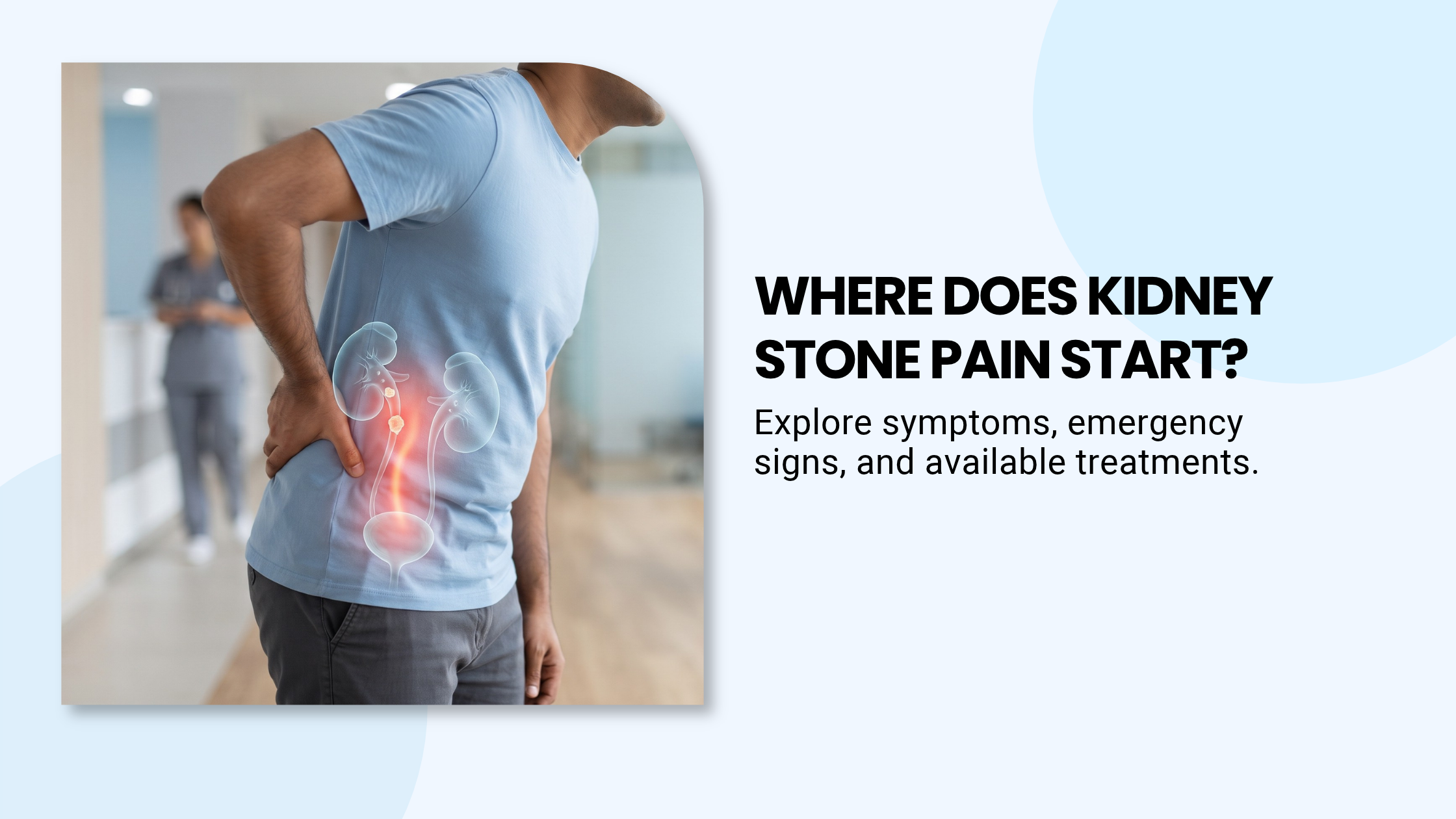 Kidney stone pain location in the lower back and side