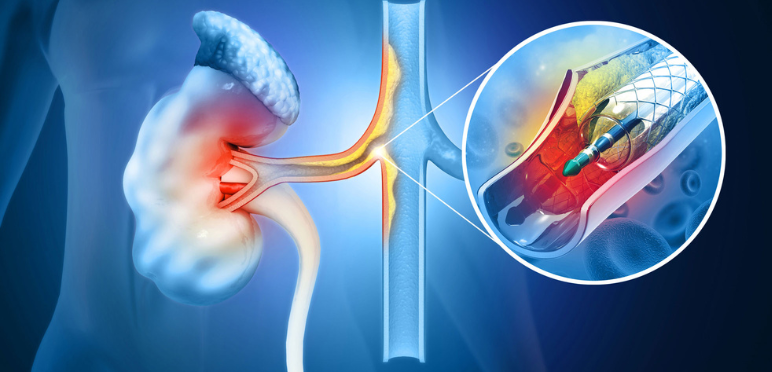 Reconstructive Urology