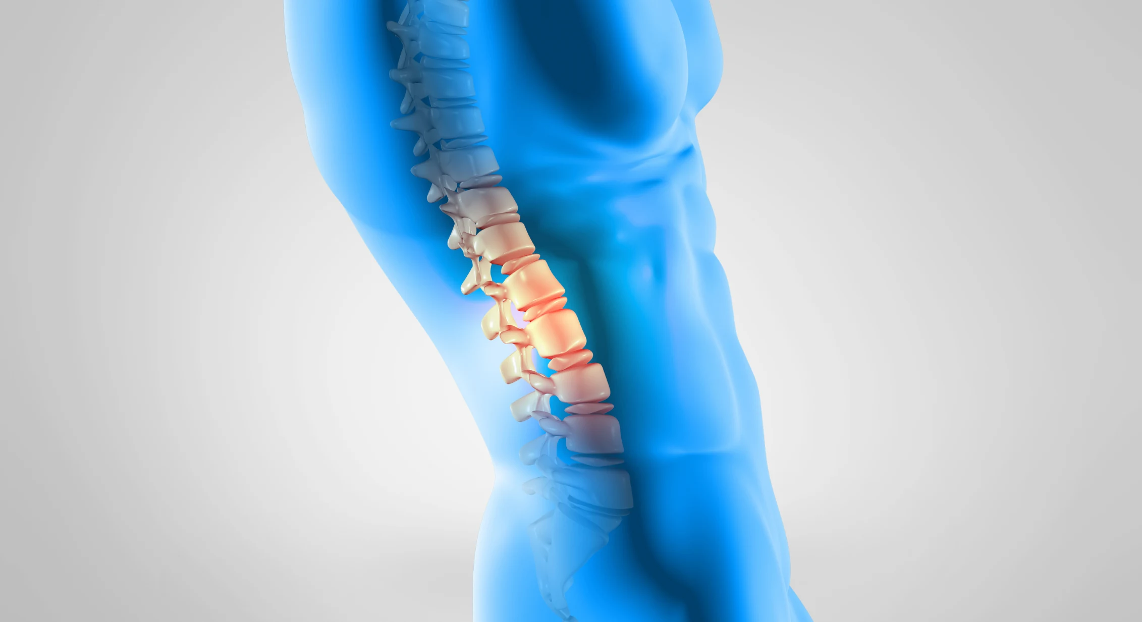 Scoliosis & Scoliosis Surgery