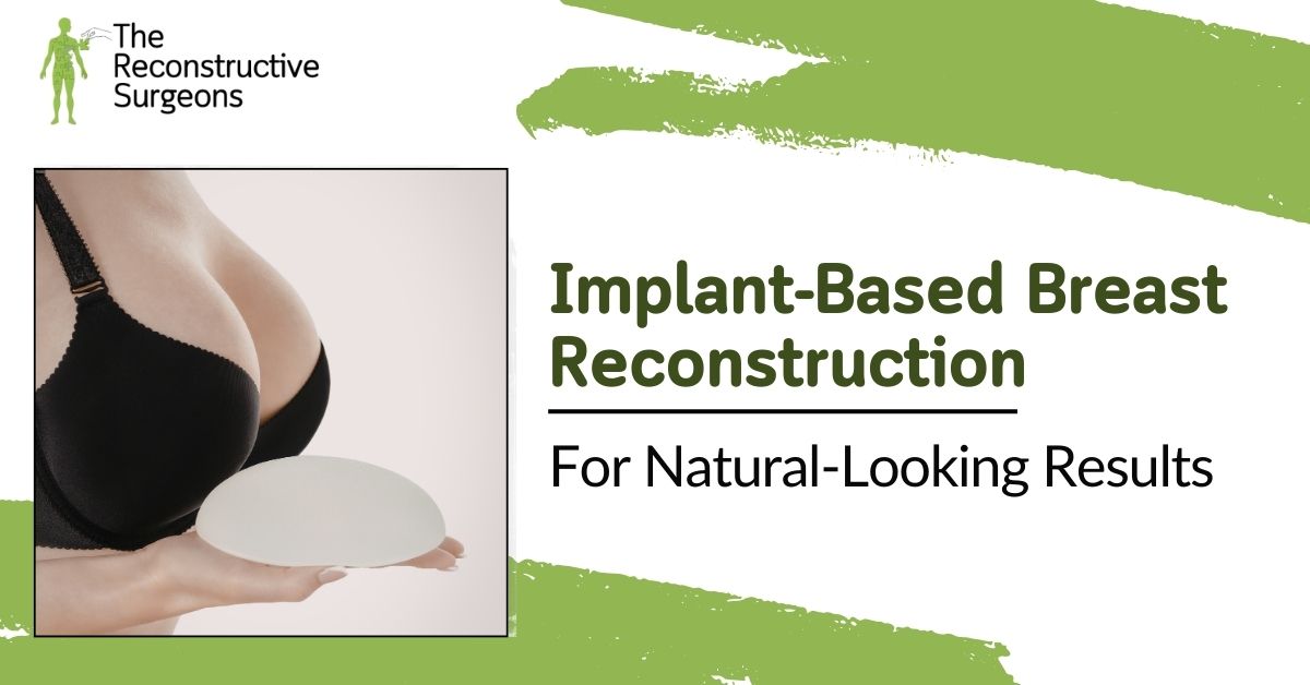 Advanced Implant-Based Breast Reconstruction