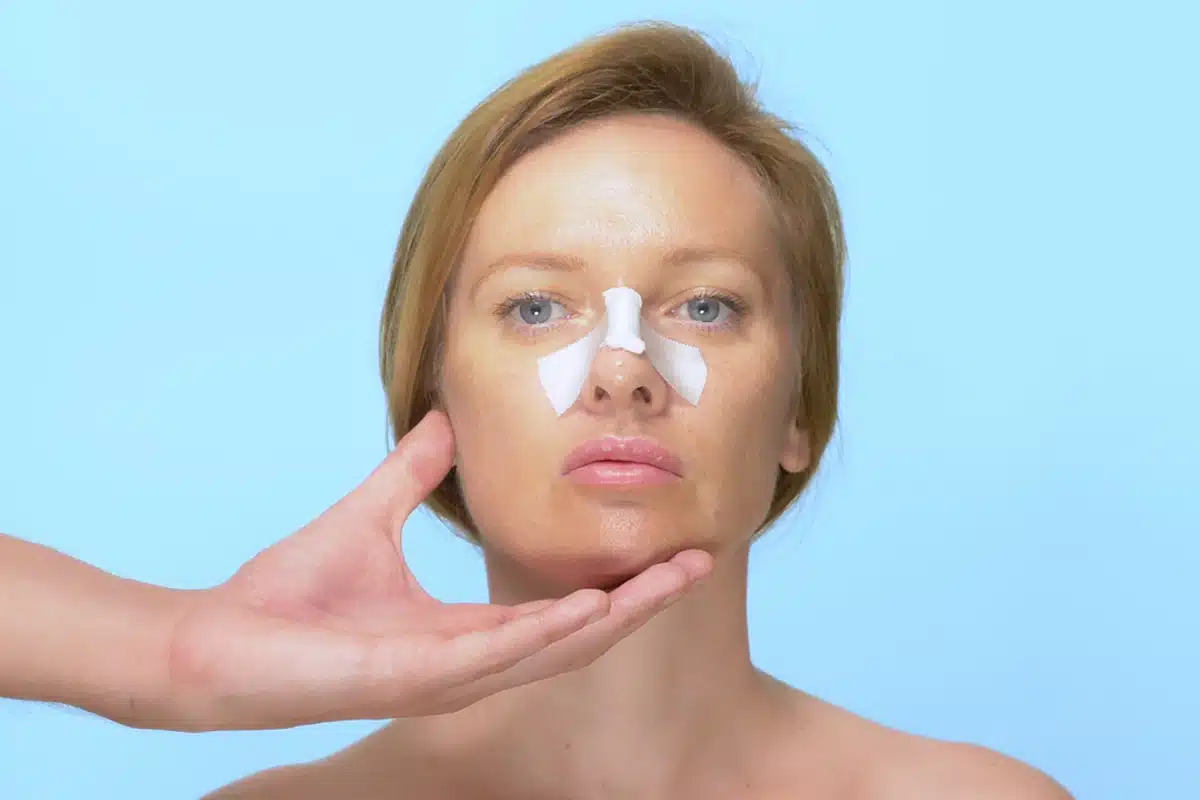 Healing After Secondary Rhinoplasty