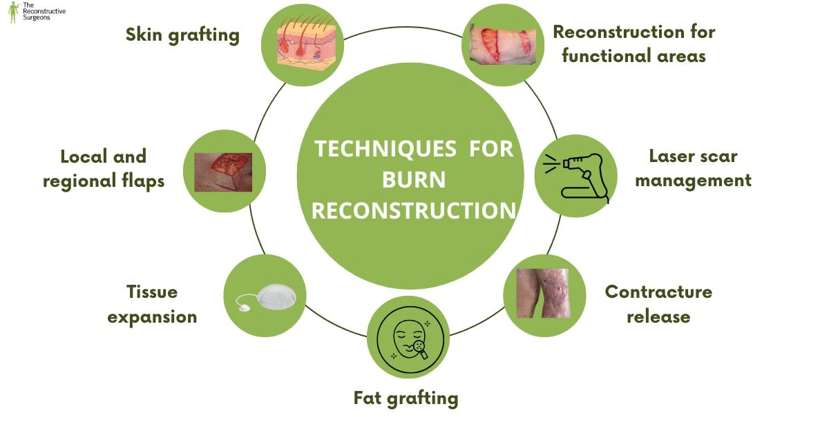 Modern Techniques Used in Burn Reconstruction
