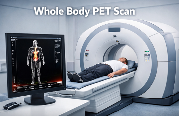 Whole Body PET Scan