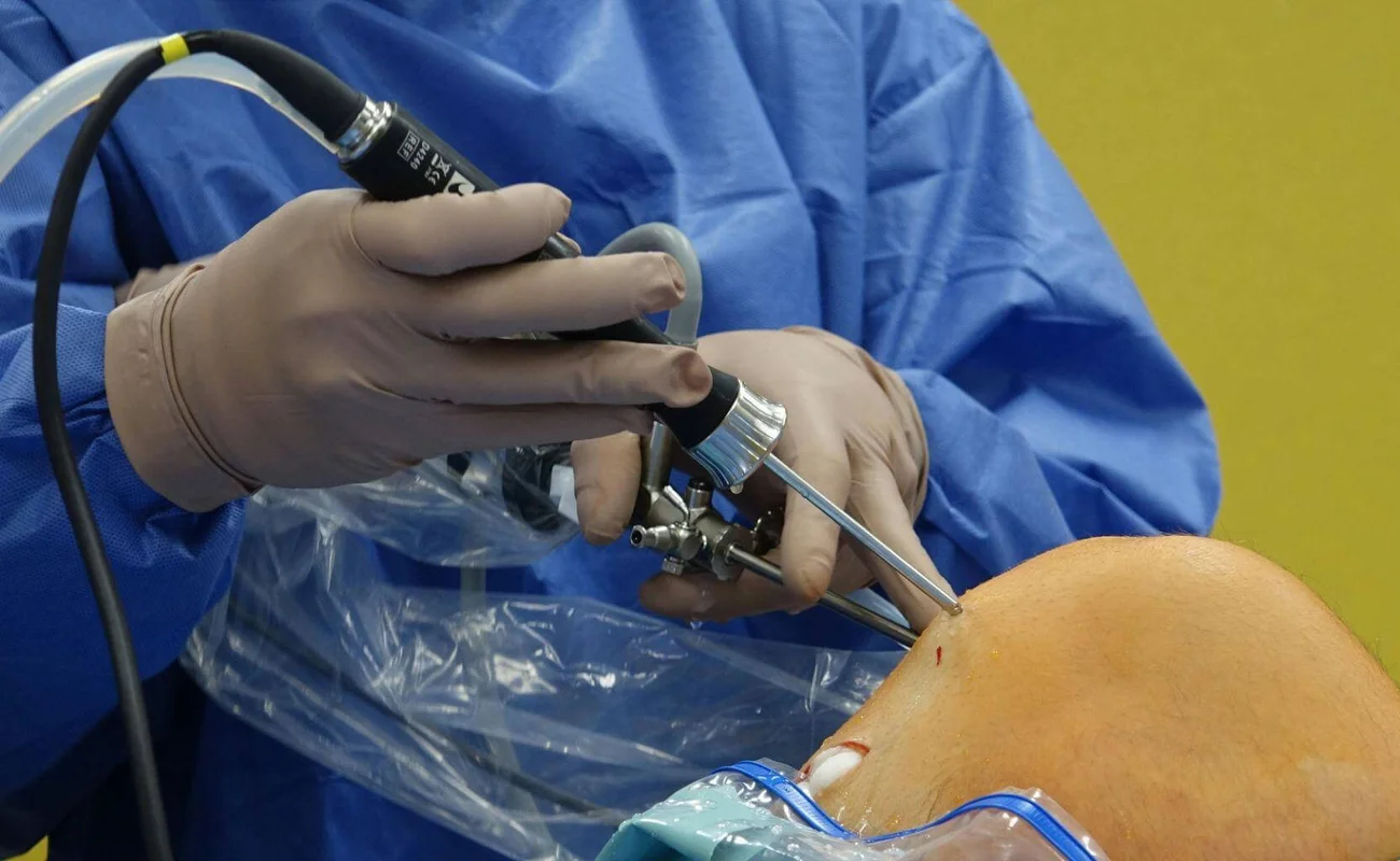 ACL Precision Surgery