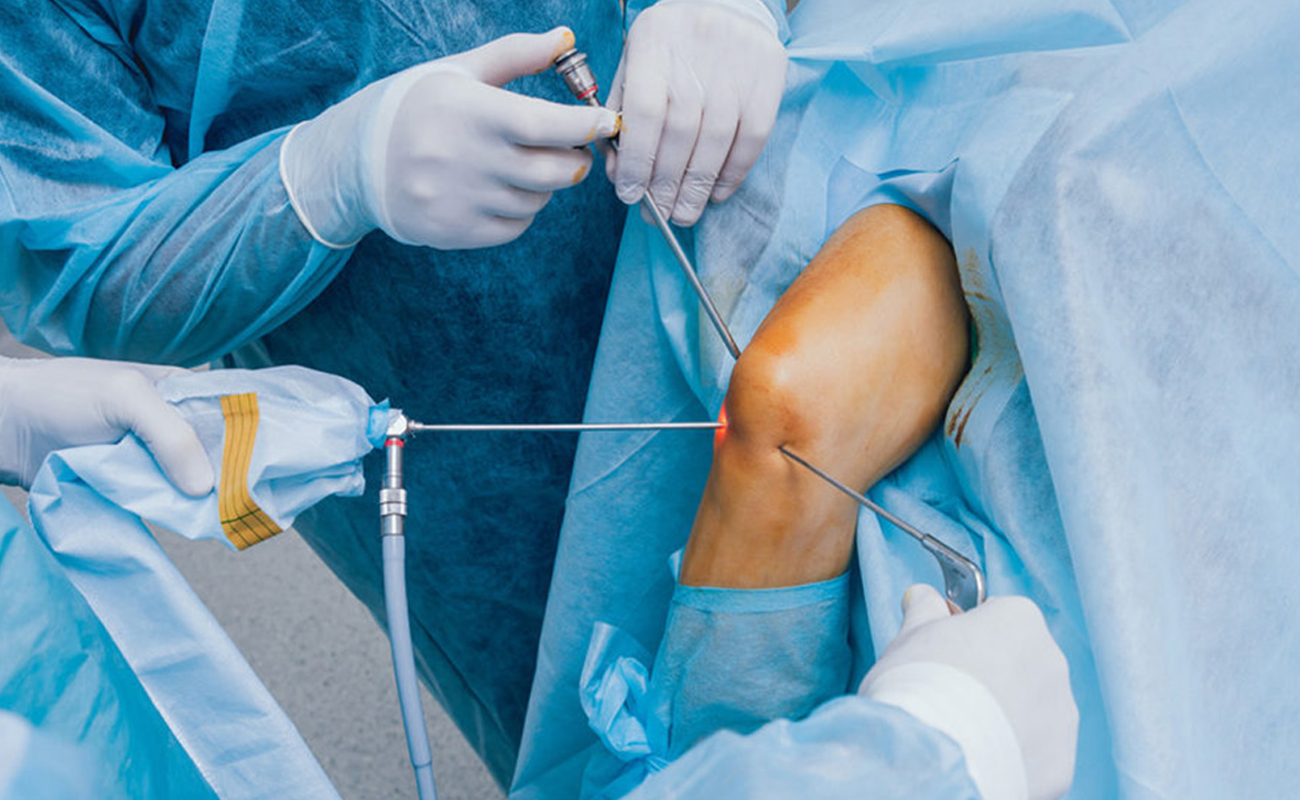 Arthroscopy