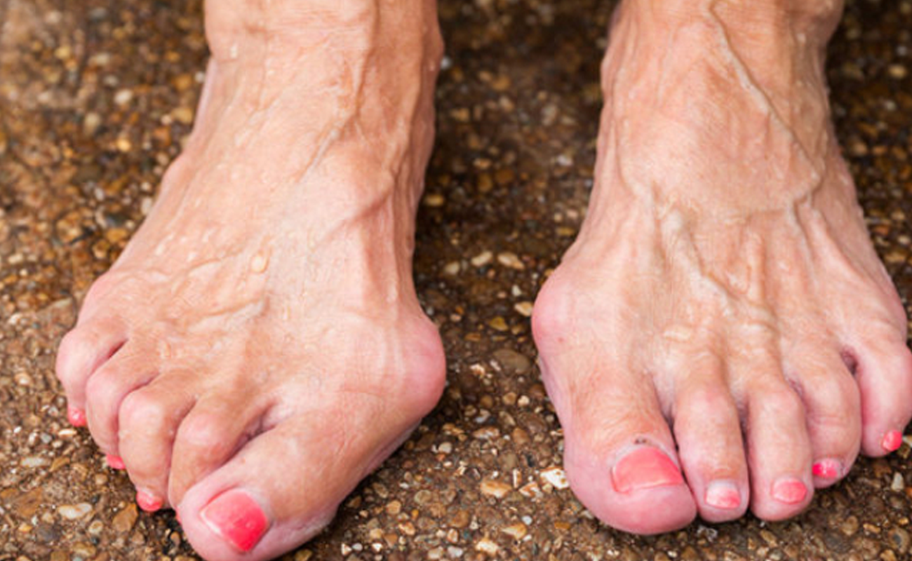 Deformity Correction