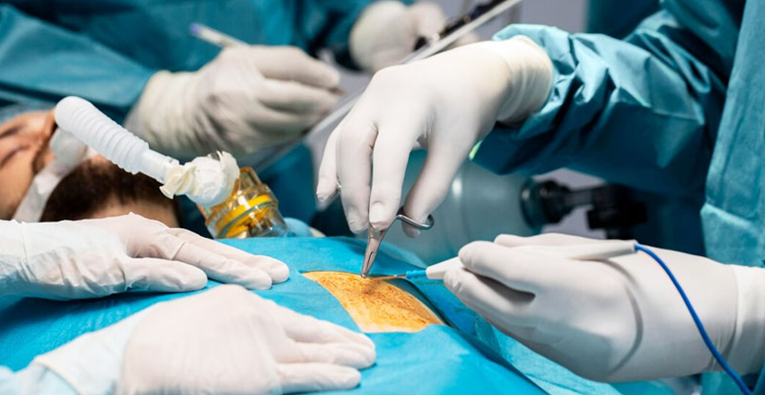 Cancer Surgeries (Gynaecological Cancers)