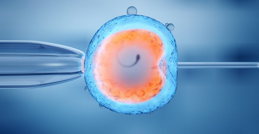 IVF (In-Vitro Fertilization)