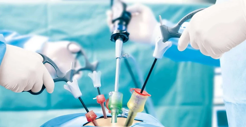 Laparoscopy (Minimally Invasive Surgery)