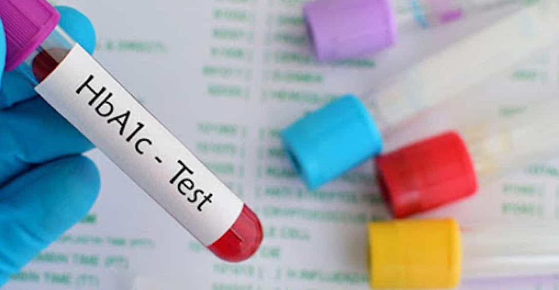 The Importance of Blood Sugar Regulation in Hypoglycemia