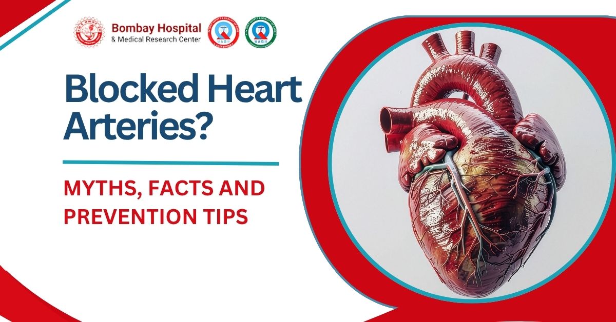 Blocked Heart Arteries: Myths, Facts & Prevention