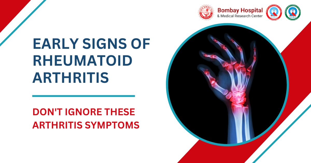 What Are the Early Signs of Rheumatoid Arthritis?