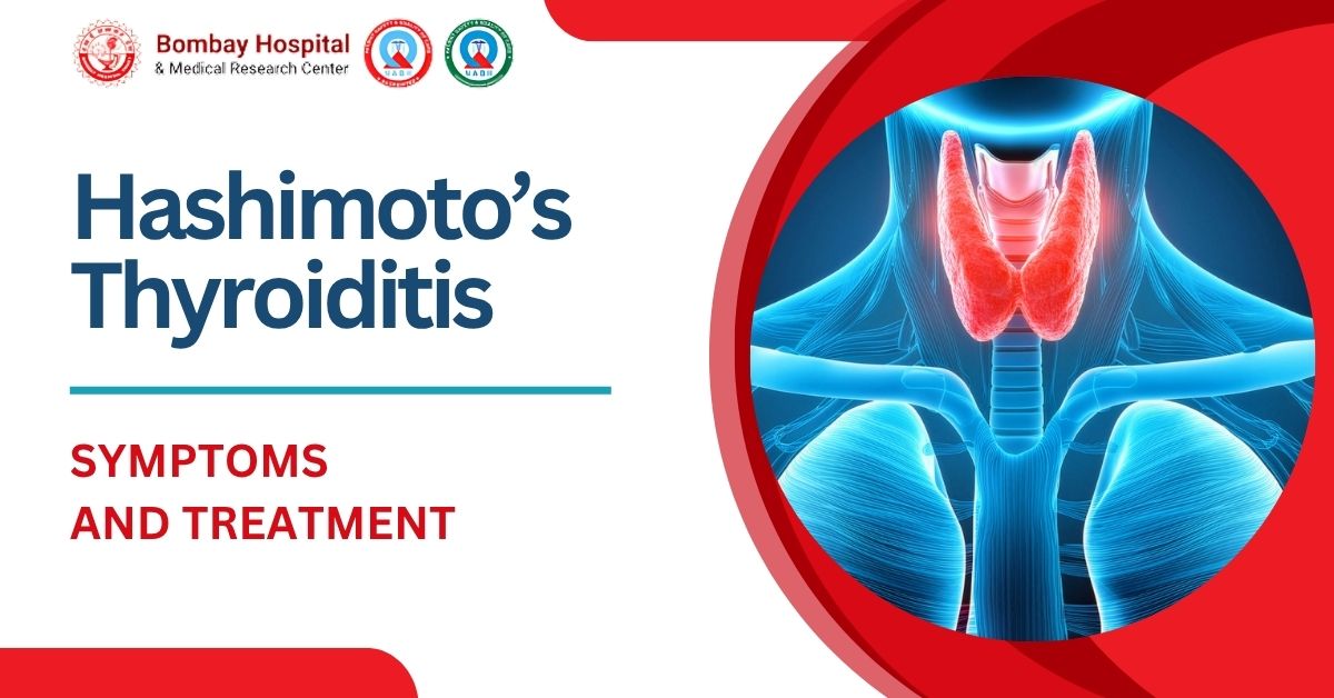 Hashimoto’s Thyroiditis Treatment at Bombay Hospital, Mumbai