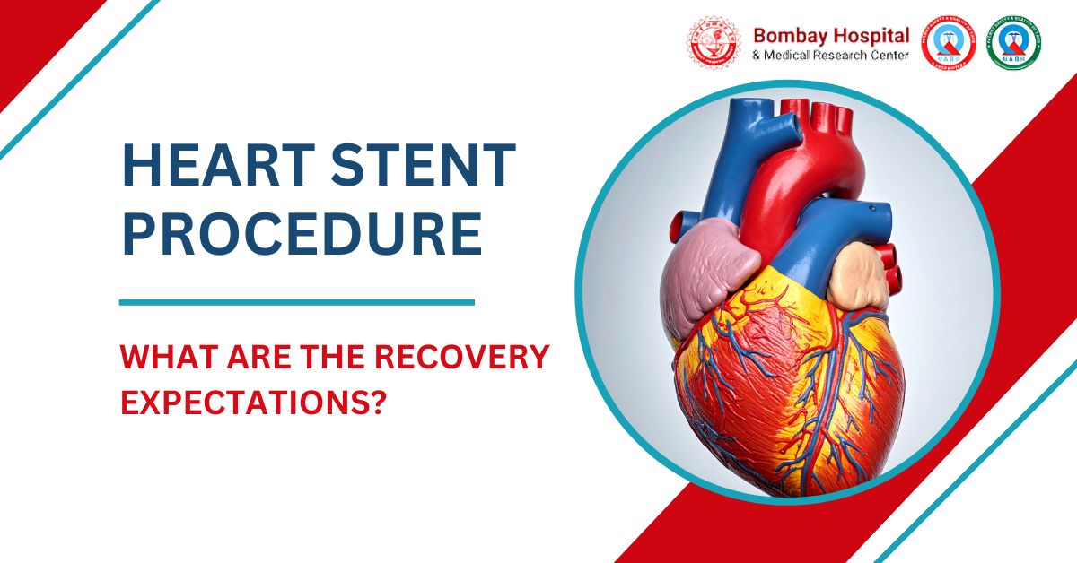 What Are the Recovery Expectations After a Heart Stent Procedure?