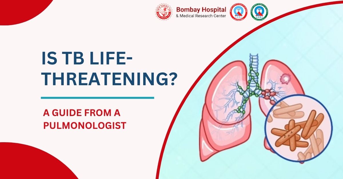 Is TB or Tuberculosis Life-Threatening? A Guide from a Pulmonologist