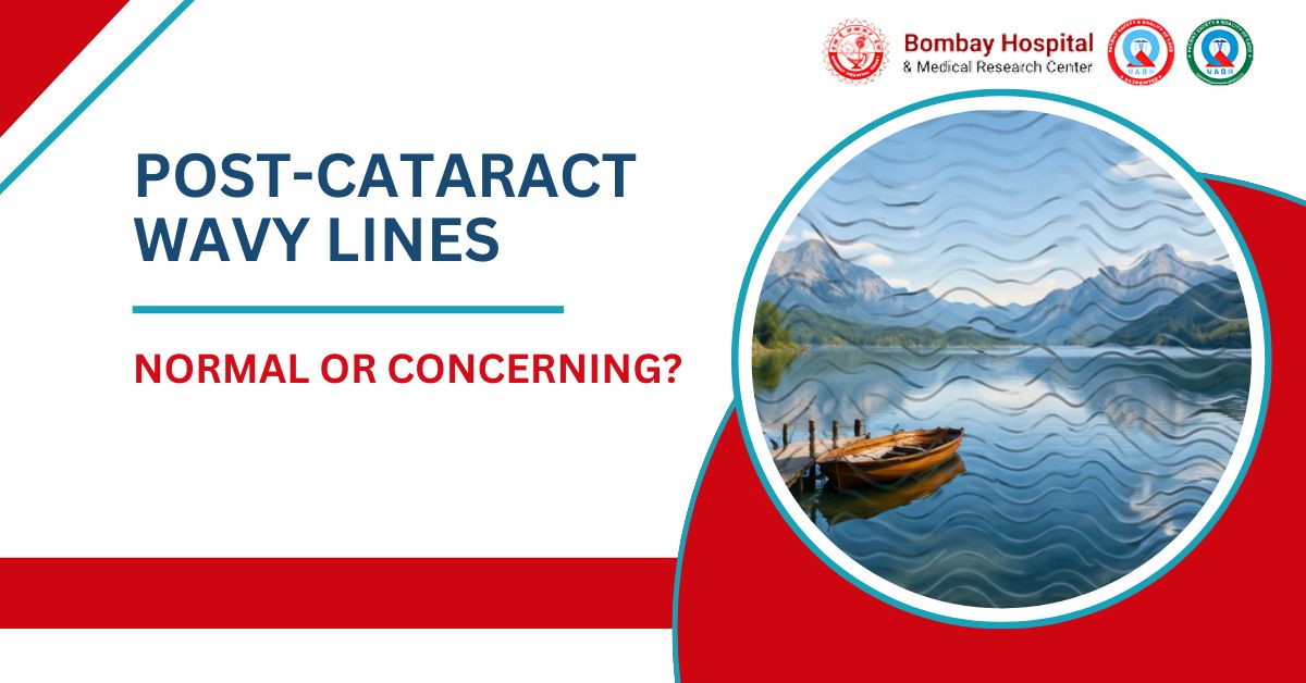 Post-Cataract Wavy Lines: Normal or Concerning Bombay Hospital in Mumbai