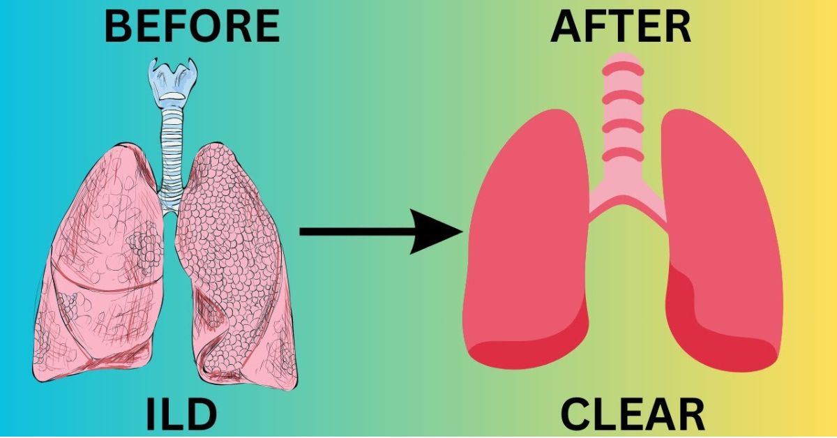 Practical Steps to Protect Your Lungs