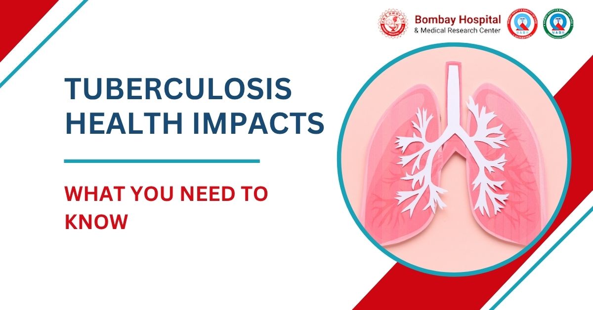 How Tuberculosis Impacts Your Health and What You Need to Know
