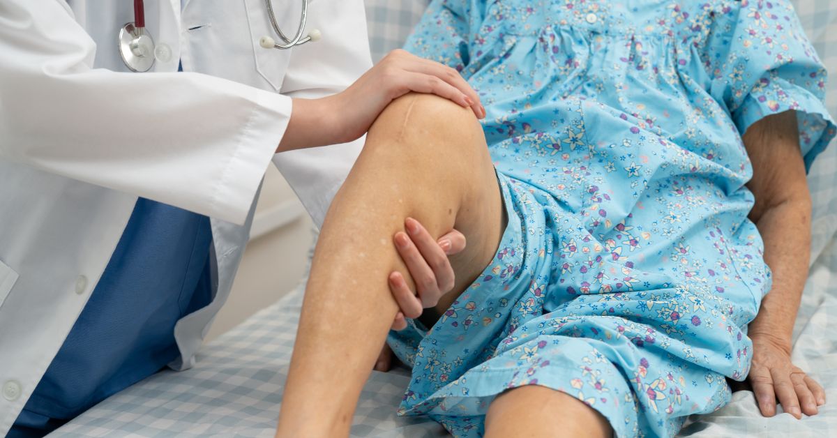 Understanding Knee Replacement in Old Age