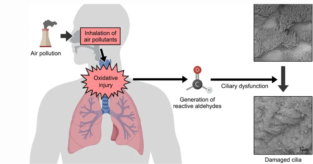 What Is Air Pollution and What Does It Contain