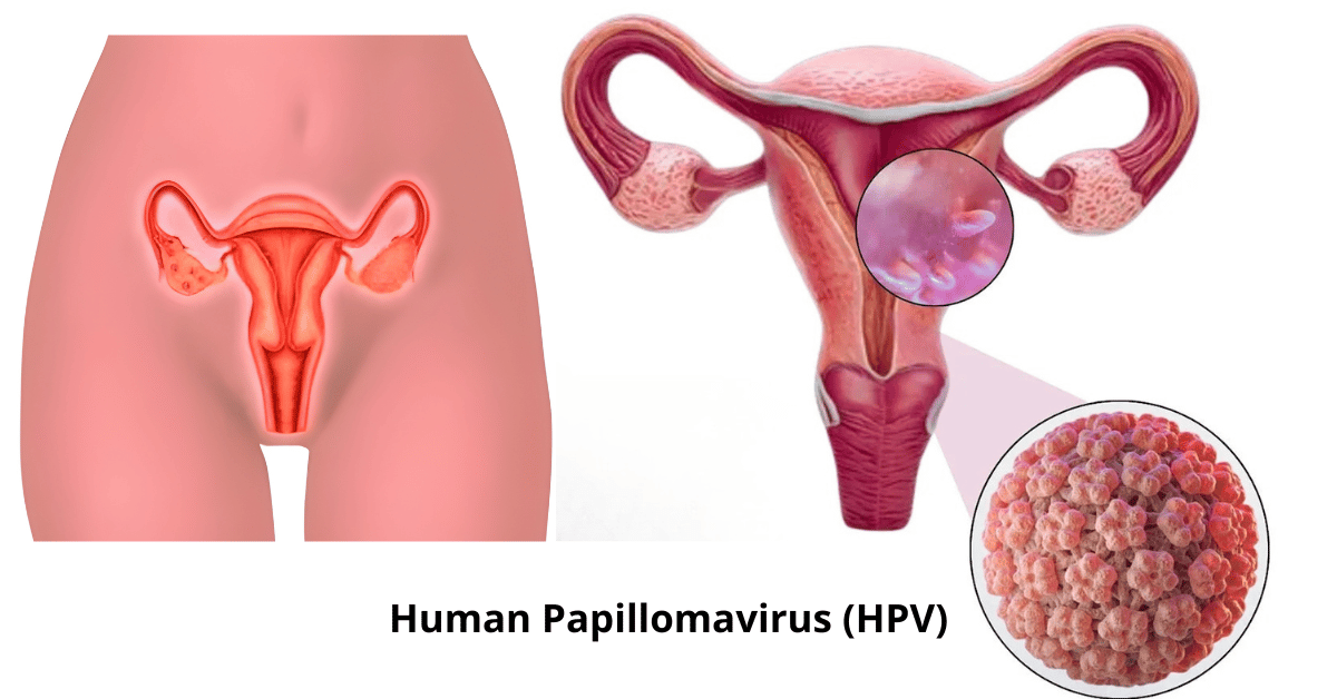 What is Human Papillomavirus (HPV)