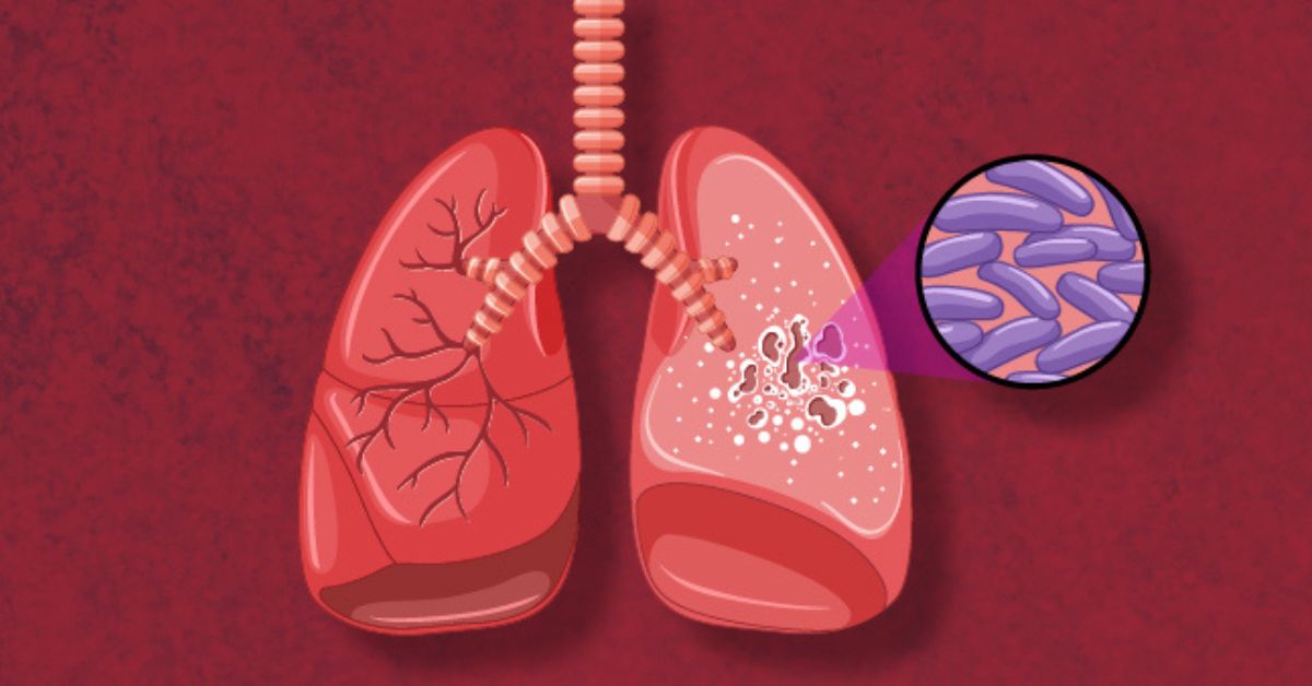 What is World Tuberculosis Day?