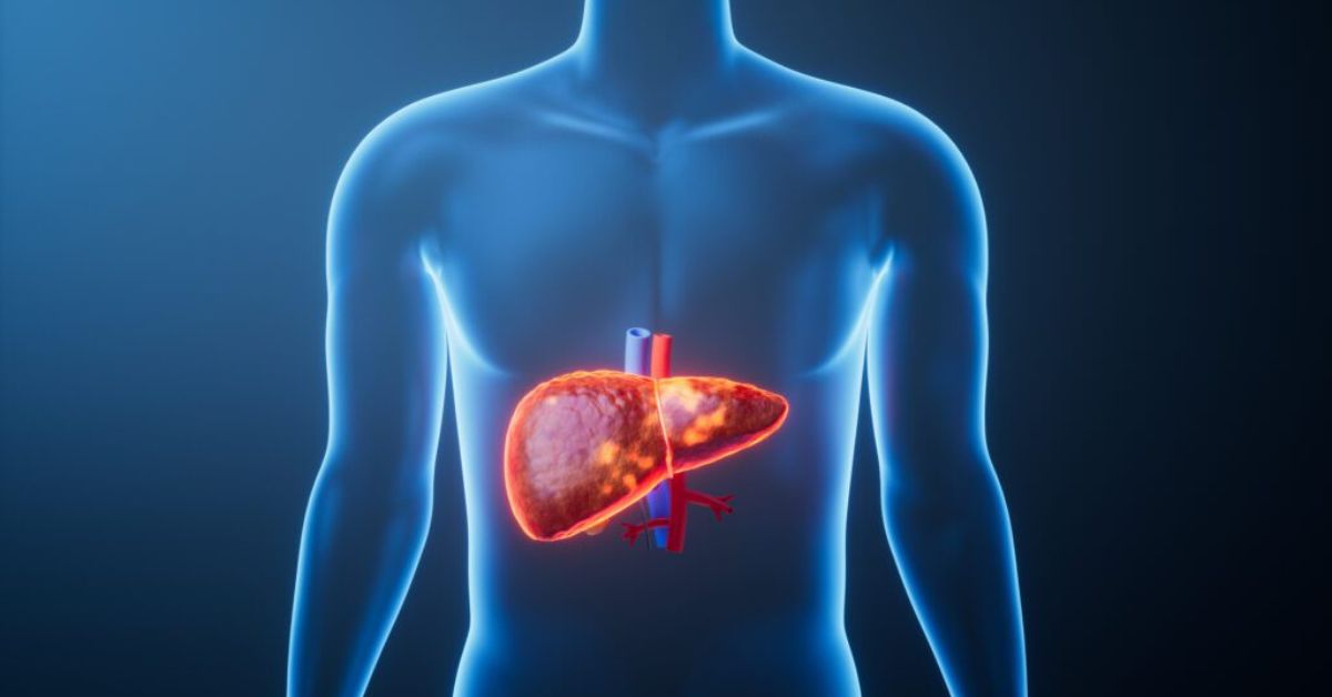 Why World Liver Day Matters