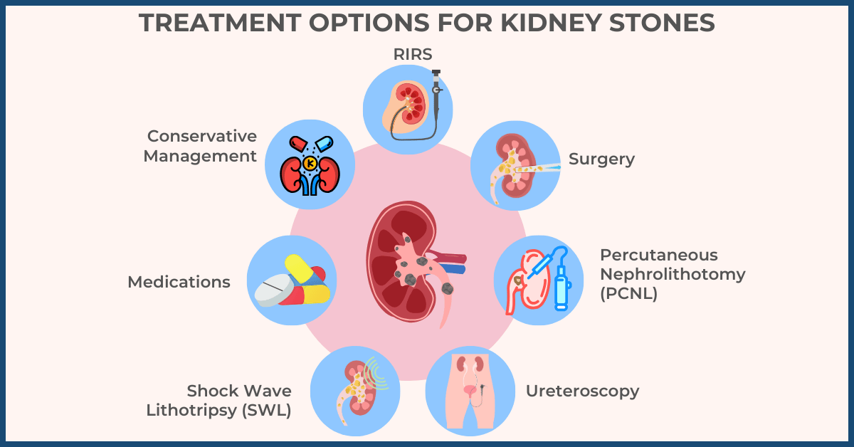 Treatment Options for Kidney Stones in Mumbai